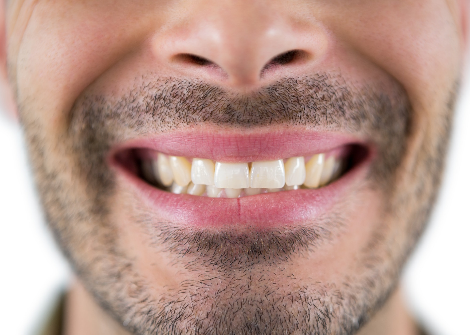 Man showing his teeth